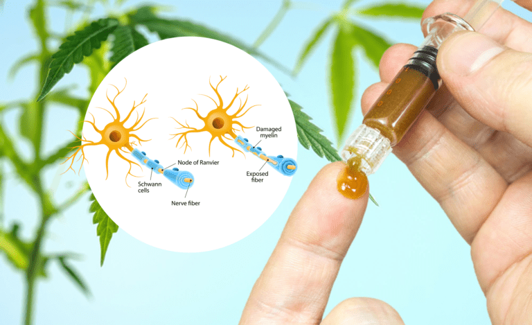 Cannabis for Multiple Sclerosis